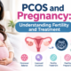 PCOS and Pregnancy