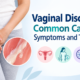 vaginal discharge