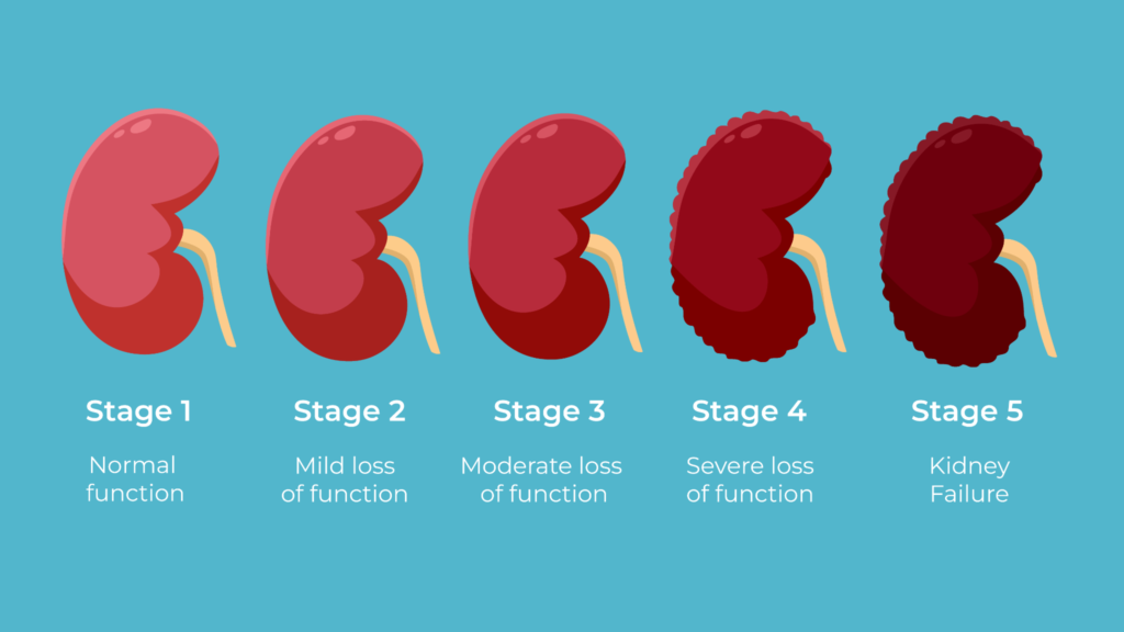 Understanding the Stages