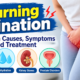 burning urination