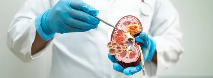 Dialysis for Kidney Failure