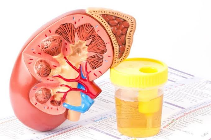What Does Protein in Urine Mean?