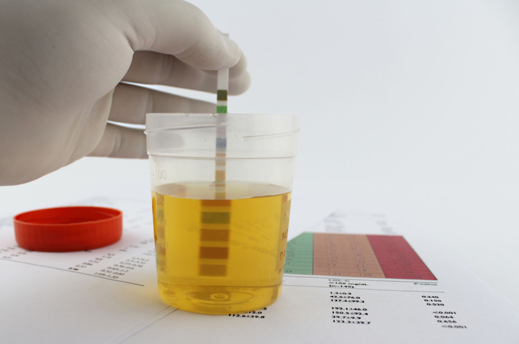 How Can You Protect Kidney Health?
